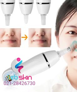 میکرودرم ابریژن دیاموند برقی - تصویر 7