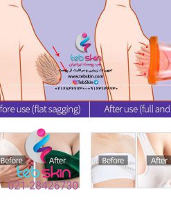 Alternative view of دستگاه وکیوم سینه و باسن